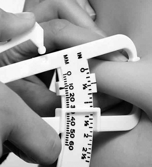 Risks of morbid obesity increase in the pandemic